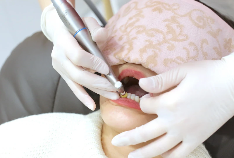 歯のクリーニング