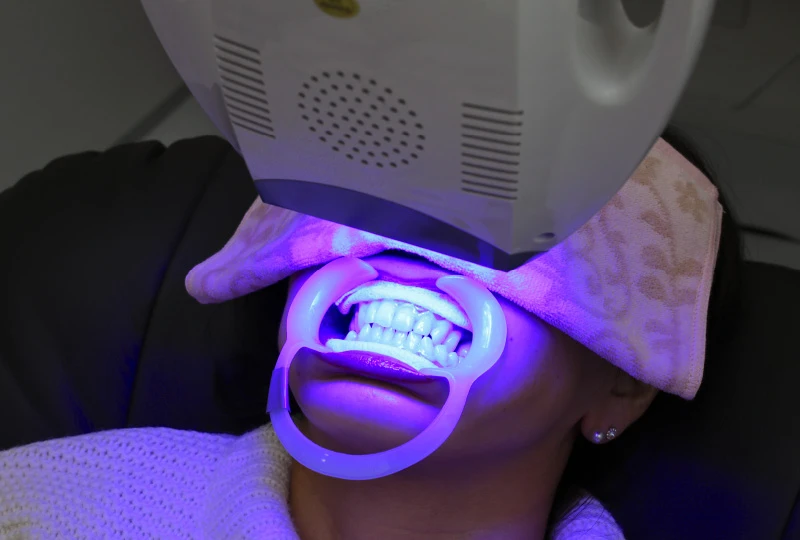 ホワイトニング薬剤の塗布と光照射