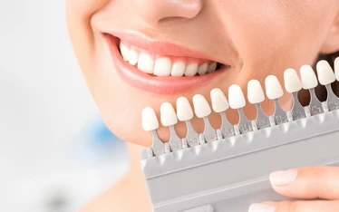 ホワイトニング後の歯の色をチェック